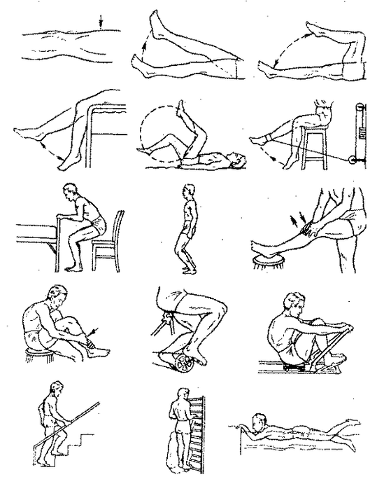 Esercizi terapeutici per l'artrosi dell'articolazione del ginocchio