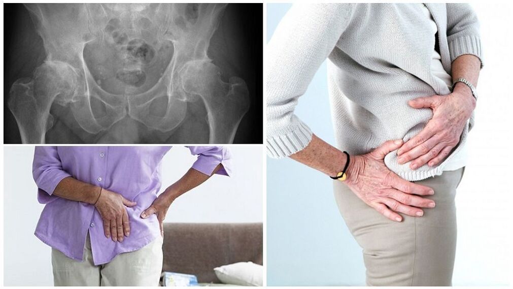 Ci sono molte ragioni per cui la patologia si sviluppa